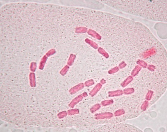 タマネギ染色体